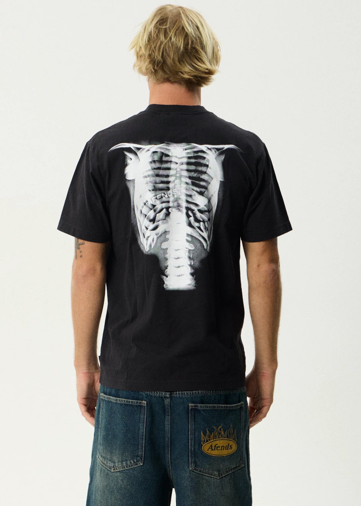 X-Ray - Retro Tee
